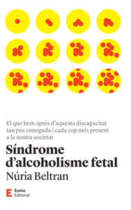 SINDROME DALCOHOLISME FETAL